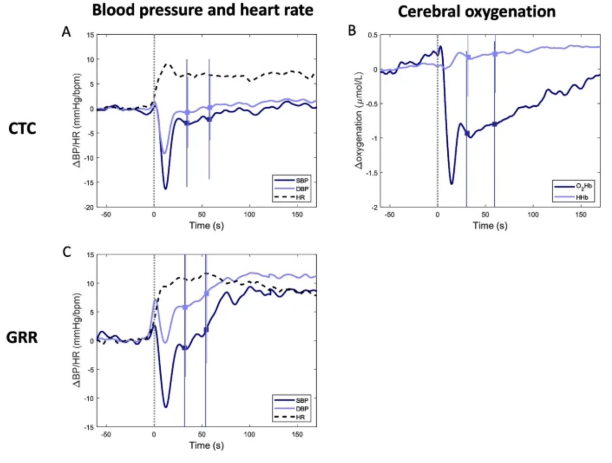 GeroScience (@geroscienceage) on Twitter photo 📢New Open🔓 Access Article Alert
Preoperative physical resilience indicators and their associations with postoperative outcomes by Marjolein Klop & Jurgen A. H. R. Claassen (<a href="/J_C_MD_PhD/">Jurgen Claassen</a>) et al.
rdcu.be/ehnA7
#resilience #orthostaticbloodpressure #gripstrength #gripwork 📢New Open🔓 Access Article Alert
Preoperative physical resilience indicators and their associations with postoperative outcomes by Marjolein Klop & Jurgen A. H. R. Claassen (<a href="/J_C_MD_PhD/">Jurgen Claassen</a>) et al.
rdcu.be/ehnA7
#resilience #orthostaticbloodpressure #gripstrength #gripwork