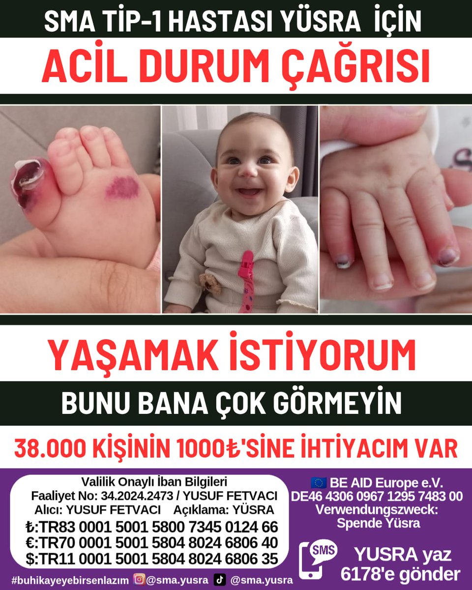 nurcin_klc's tweet photo. #sma #smahastası #zolgensma 

#ÖğretmeneKabineden68BinAtama #ADF2025 2024 KPSS Ekrem İmamoğlu #SONDAKİKA #enterprisedanfinalbileti #ÖğretmeneKabineden68BinAtama Hayırlı  #AhmetMinguzziEmsalOlsun #iklimtasmasınahayır 2024 kpss #GecikenKademeZulumdür Timur Soykan Akın Gürlek https://t.co/P3vN8fnrff
