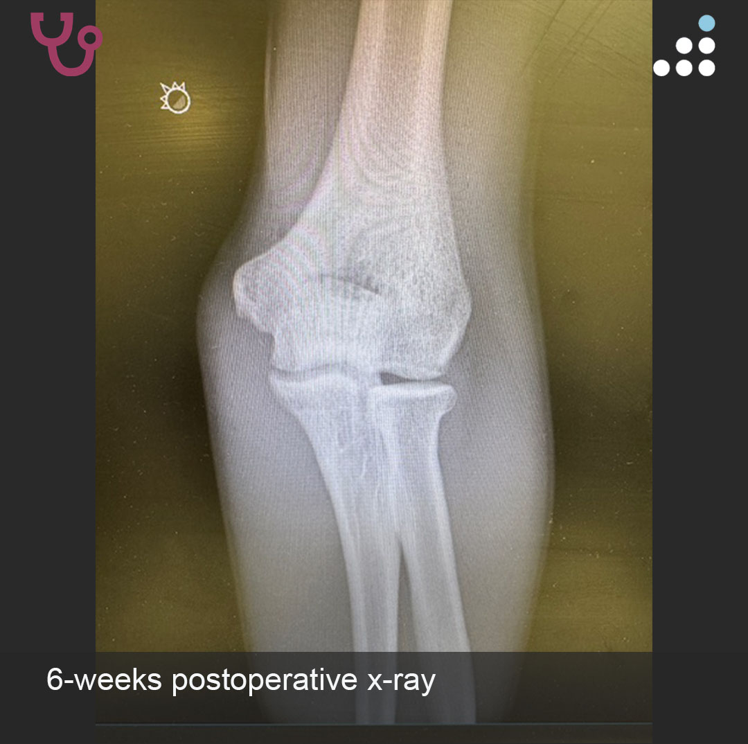 Orthobullets tweet media