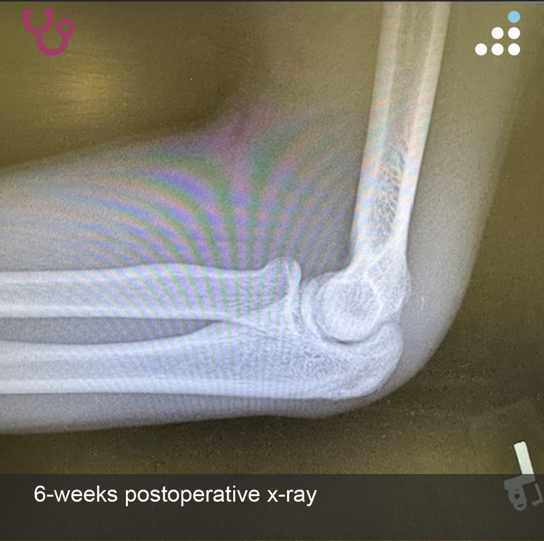 Orthobullets tweet media