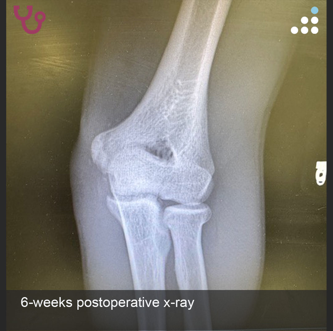 Orthobullets tweet media