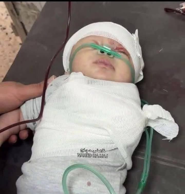 abdazizmo7amd's tweet photo. For those who care, if there is someone who cares about us

The baby Sham Muhareb, the daughter of my friend, nurse Imad Muhareb, was martyred a little while ago, she ascended to the justice of the sky with amputated hands and two wings after the bombing of the Israeli army https://t.co/51iDkqVuf8