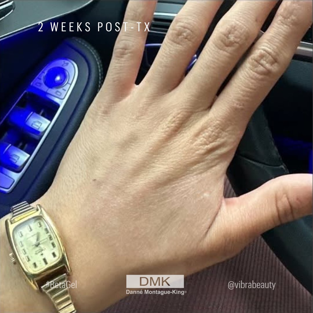 💚 DMK International | Professional Skincare 💚 tweet media