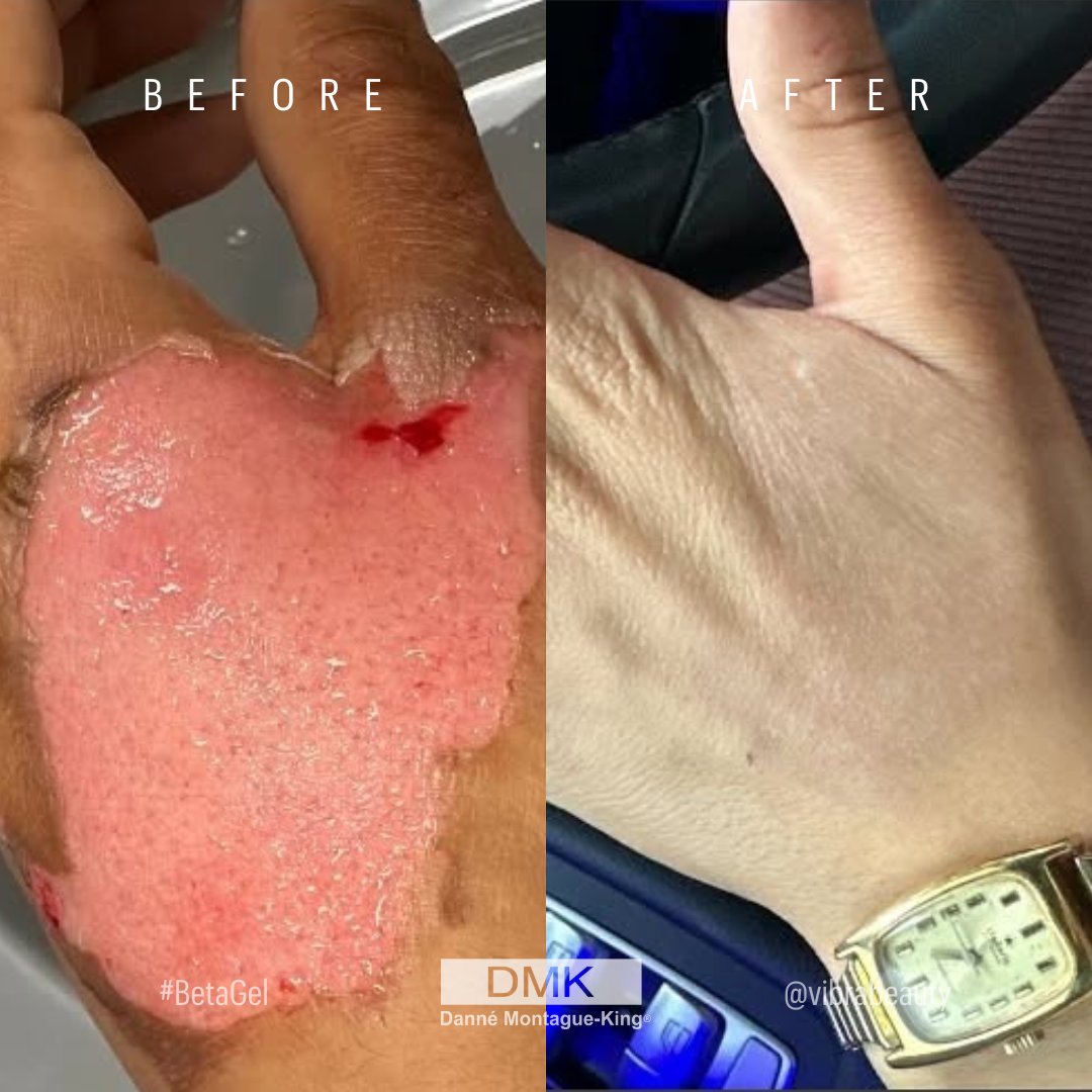 💚 DMK International | Professional Skincare 💚 tweet media