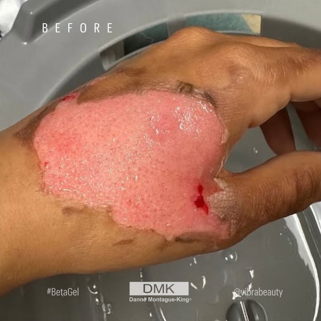 💚 DMK International | Professional Skincare 💚 tweet media