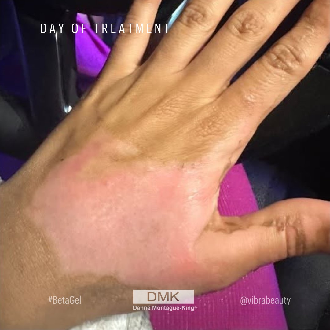 💚 DMK International | Professional Skincare 💚 tweet media