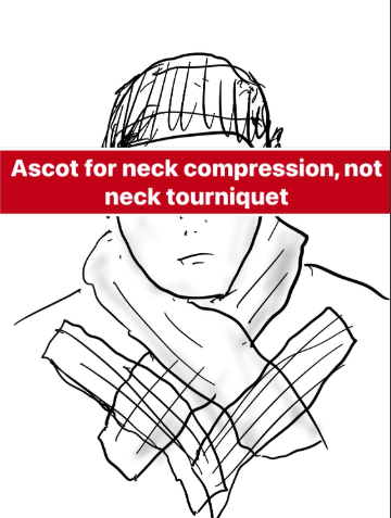 When you need some mild to moderate neck compression for swelling after CEA, I use an Ascot.