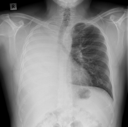 1️⃣ Master problem representation

Early in a case, keep your problem definition broad.
As diagnostic certainty grows, narrow and define the problem precisely.

➡️ Start loose ("respiratory failure")

➡️ Refine with data ("hypoxemic failure, likely pneumonia")

➡️ Finalize with
