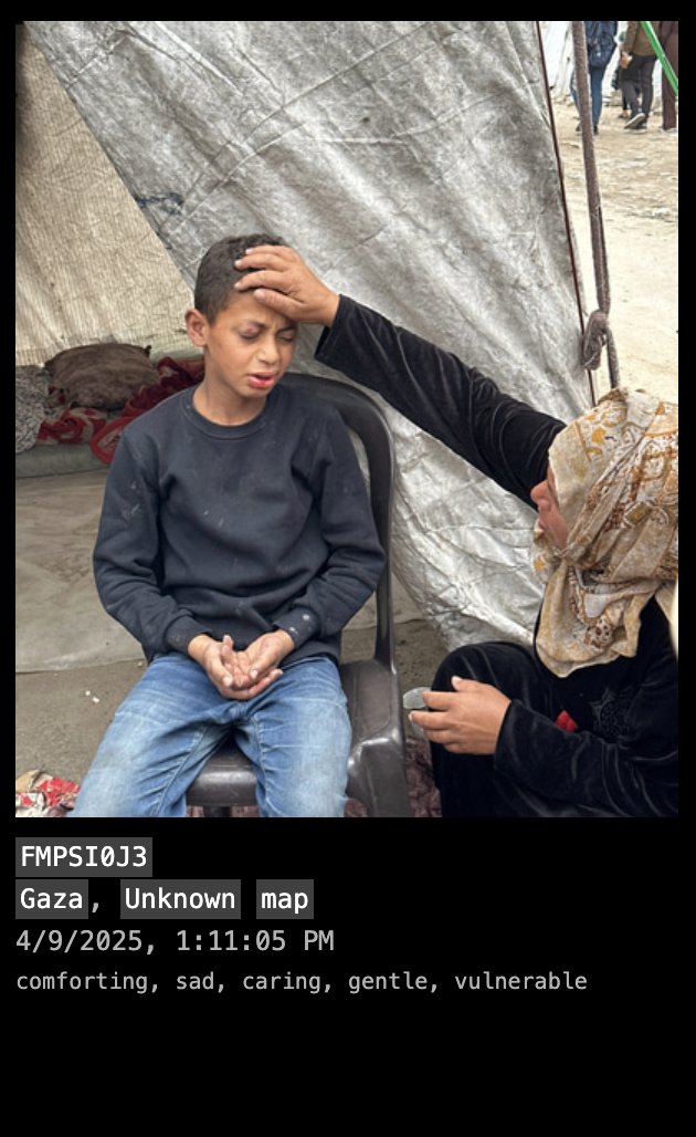 collective_memo's tweet photo. The unhygienic and unsanitary conditions in these camps are fueling the spread of illness, especially among children. Reports point to a rise in skin infections like scabies and impetigo- directly linked to the lack of clean water and basic hygiene facilities. #TheChildrenOfGaza