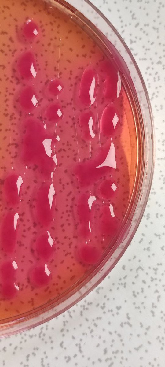 Klebsiella species? I know you are more likely to agree, especially if you don't have enough resources for identification.

This is Pantoea species.

Brethren,  if you don't know an organism ID, and the sensitivity test shows many resistance,  don't conclude the patient is