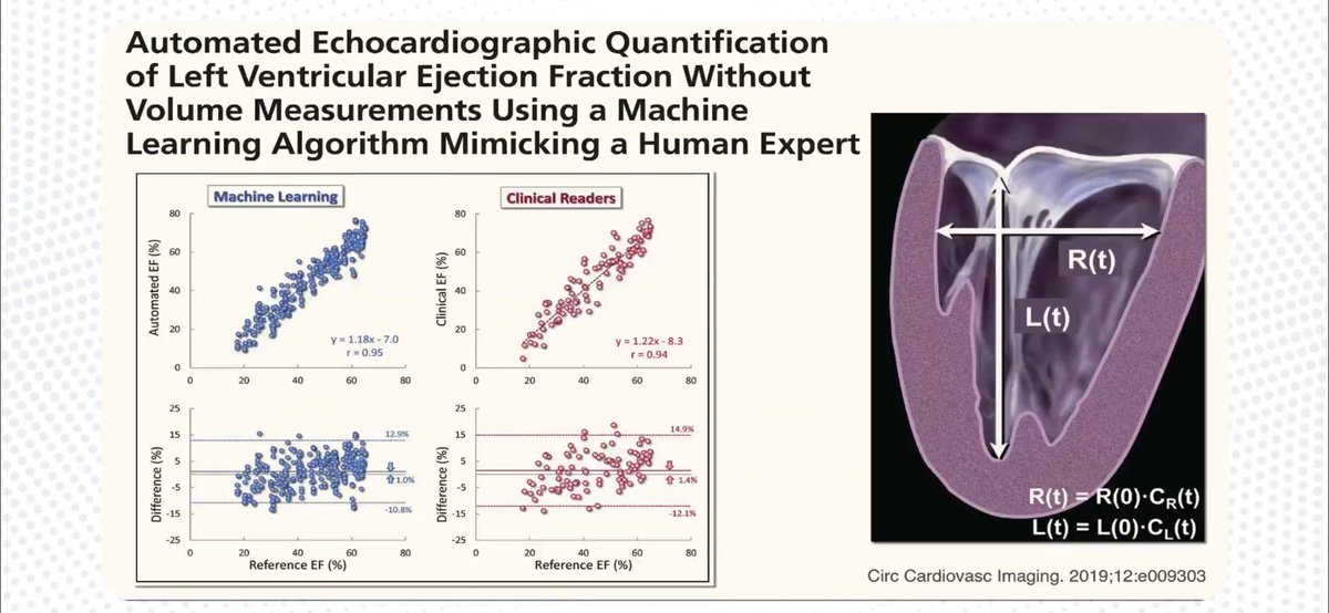 HanCardiomd's tweet photo. Screening of Cardiac contractile dysfunction by using AI and Automated #EchoFirst Quantification of LVEF using ML Algorithm
#AIinCardiology #AIinCardiovascularMedicine #AI #MasterClassIC
@carlosguizars @vass_vassiliou @rafavidalperez @BartoszHudzik @mmamas1973 https://t.co/oE9vZSQVqh