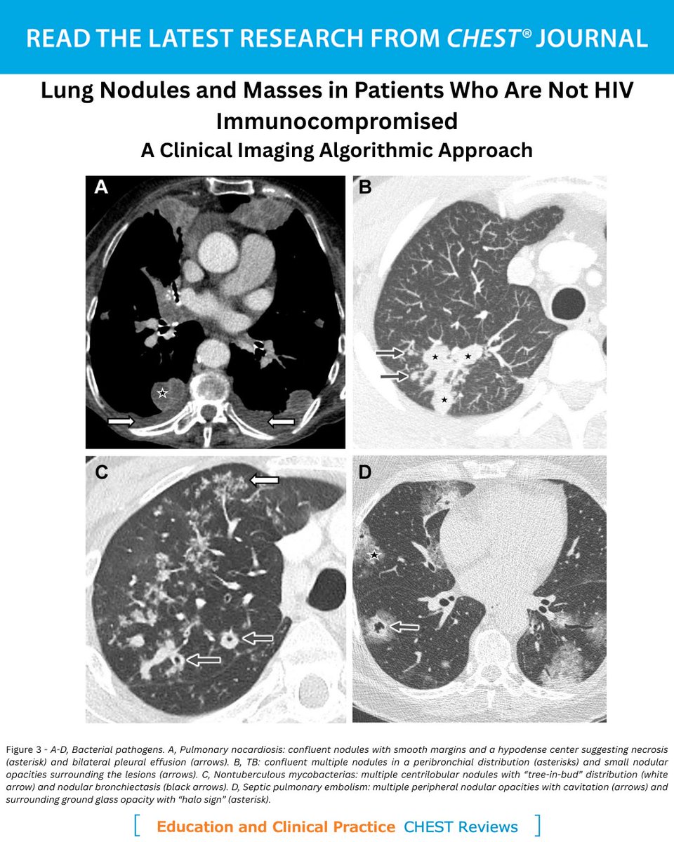 accpchest's tweet photo. A #CHESTReview presents an algorithmic approach for differentiating between various causes of pulmonary nodules &amp; masses in individuals without #HIV who are #immunocompromised, providing a valuable tool for clinical practice. Read more: https://t.co/4wuoTWGSqD
#MedTwitter #MedEd https://t.co/nYtpreqiaG