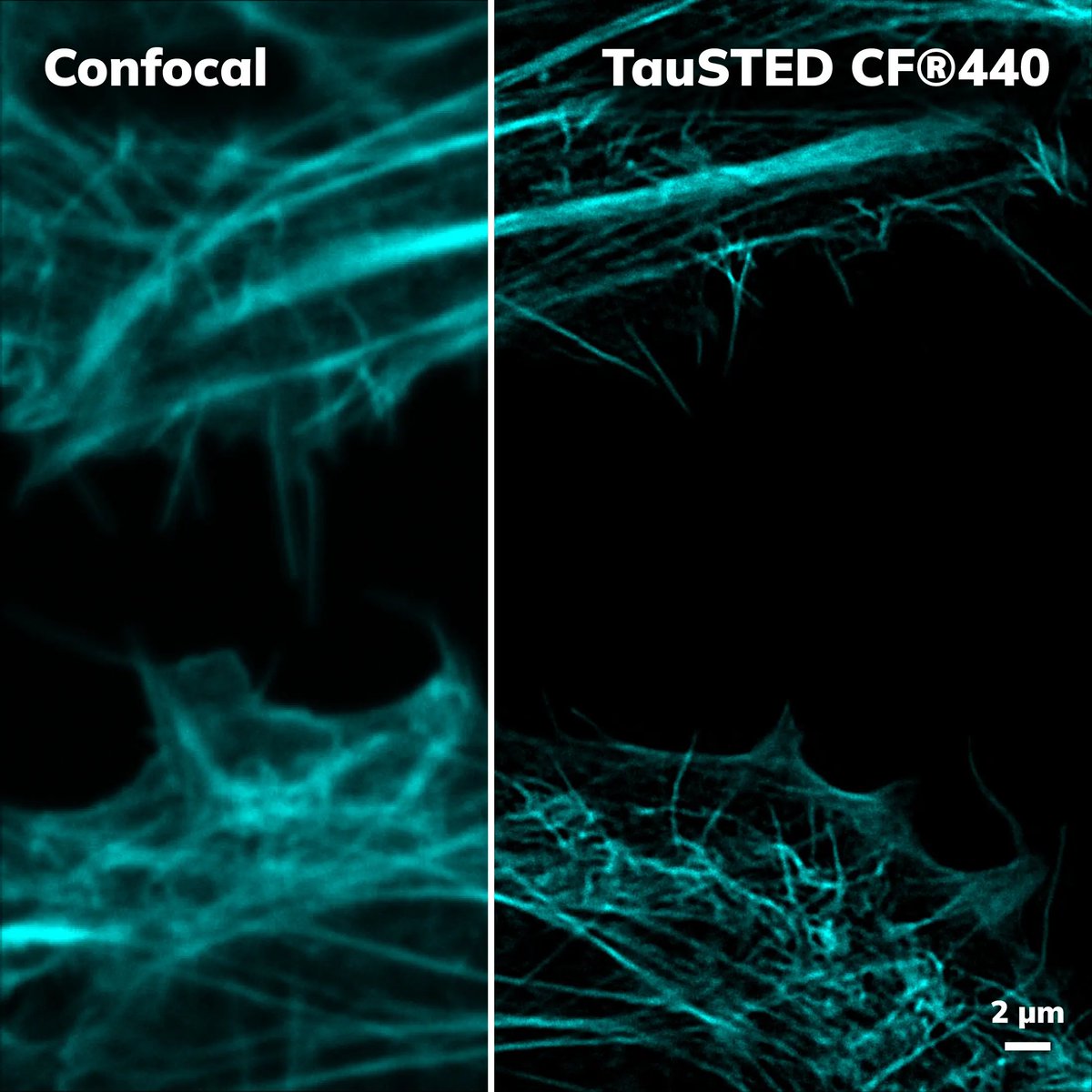 biotium's tweet photo. It's #FluorescenceFriday! Check out these stunning new images showcasing our CF® Dyes for #SuperResolution!
Full captions & CF® Dye advantages at: https://t.co/iVDQYjvzMC
#microscopy #bioimaging #cellularimaging #mammaliancell #cfdye #STED #STELLARIS #Confocal #Microscope https://t.co/43I1CycCjb