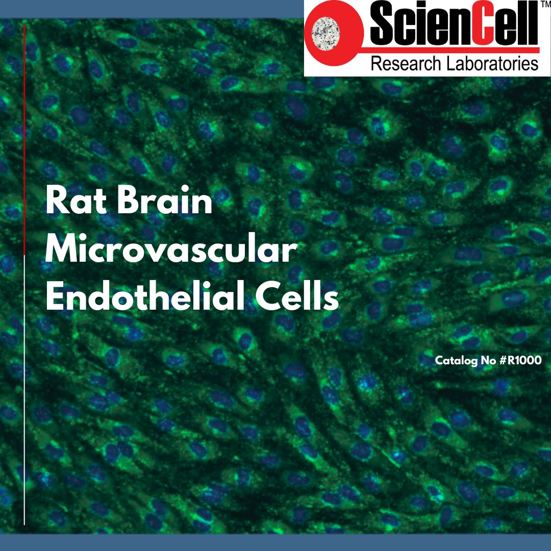 sciencell's tweet image. Why Choose Our R1000 Cells?
✔️ Optimized for BBB integrity studies
✔️ High cell viability
✔️ Ideal for co-culture with astrocytes &amp;amp; pericytes
Take your neuroscience research to the next level.

#BrainMicrovascularCells #NeuroscienceTools #PrimaryCellCulture #BBBIntegrity