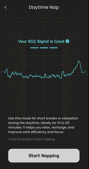 hypnus_ai's tweet image. 🚀 New Upgrades Series | No.2

👀Real-Time Brainwave Visualization is LIVE!

🏪Day or night, Hypnus guards your sleep and naps.

📱Now you can see your brain activity as it happens directly in your app! 
#NeuroTech #BrainData #Neurology