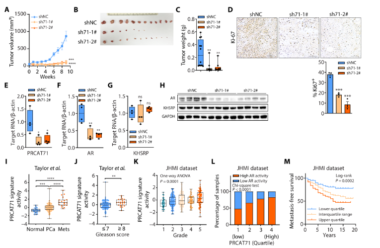 Adam B. Weiner, MD (@adam_weiner535) on Twitter photo 🚨AR signaling and lncRNA🚨
📰Just published in <a href="/ScienceAdvances/">Science Advances</a>
👉Qi Cao's lab <a href="/NM_Urology/">NM Urology</a> show lncRNA PRCAT71 plays a role in stabilizing AR mRNA in #prostatecancer progression
🙏Thankful to be able to play a small role in this remarkable work
🔗shorturl.at/6tg3z 🚨AR signaling and lncRNA🚨
📰Just published in <a href="/ScienceAdvances/">Science Advances</a>
👉Qi Cao's lab <a href="/NM_Urology/">NM Urology</a> show lncRNA PRCAT71 plays a role in stabilizing AR mRNA in #prostatecancer progression
🙏Thankful to be able to play a small role in this remarkable work
🔗shorturl.at/6tg3z