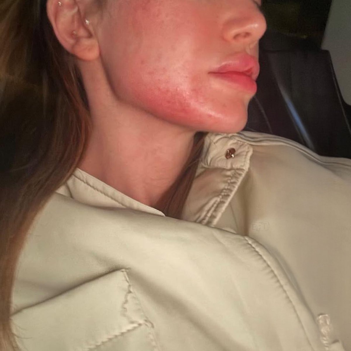 Danla Bilic, eski sevgilisi Berk Çetin tarafından şiddete uğradığını açıkladı.