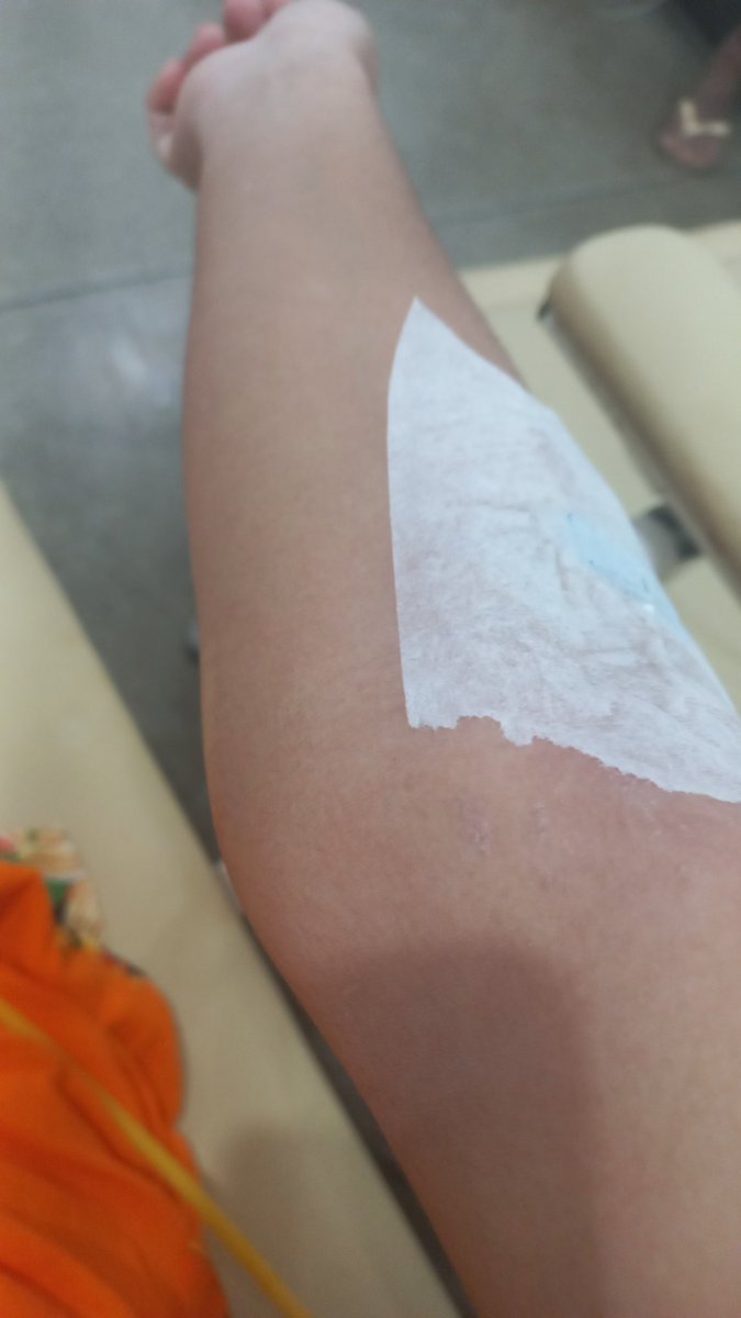 aaronwrrn's tweet photo. atualização da minha queimadura: fui na upa, chegando lá o médico ficou put pq a enfermeira do posto n receitou antibiótico. Tomei qse 2 litros de soro e ele passou pomada e antibiótico https://t.co/GMYwVwEAWP