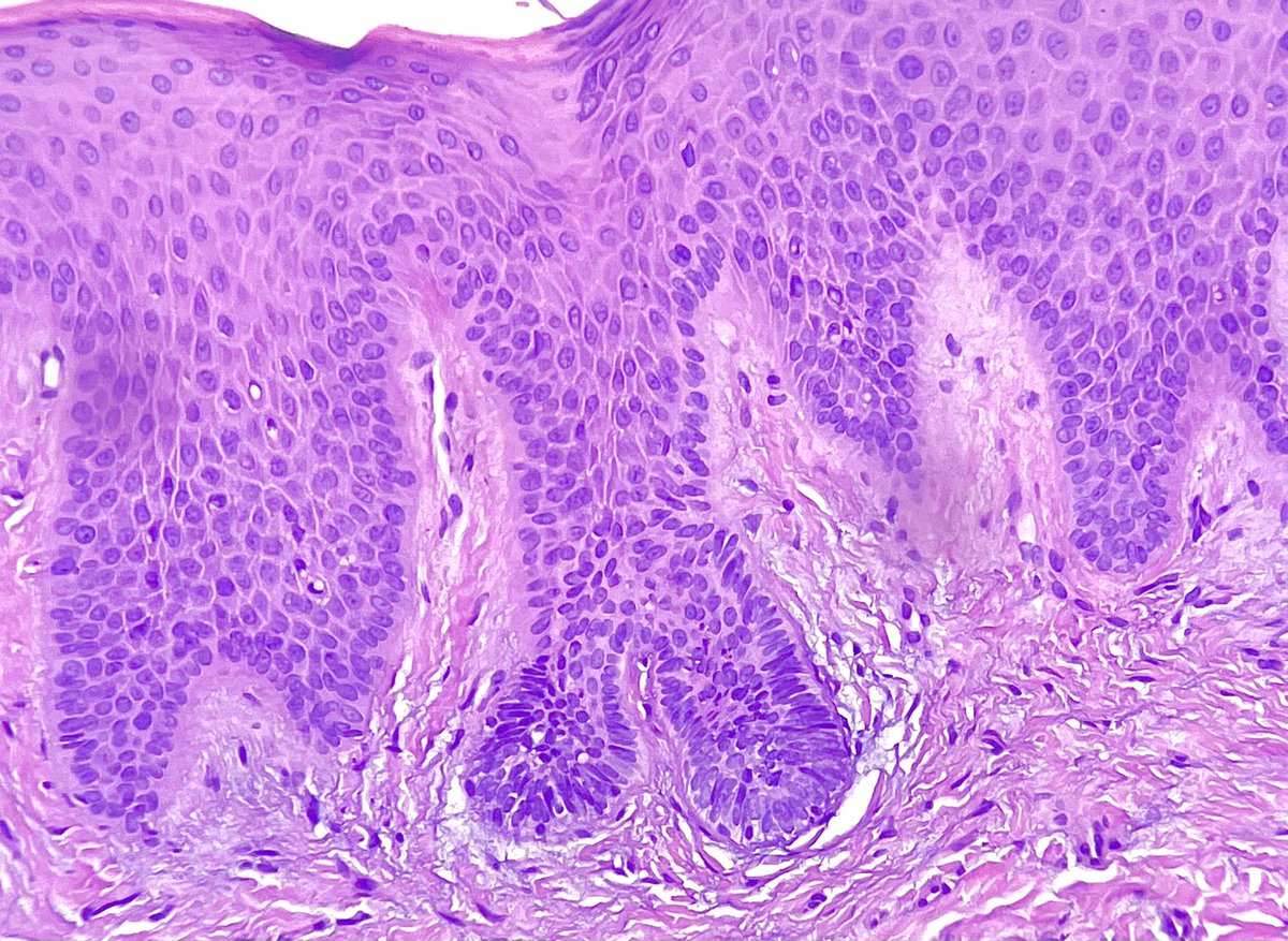 Hashimoto__0's tweet image. Oral cavity, gingiva