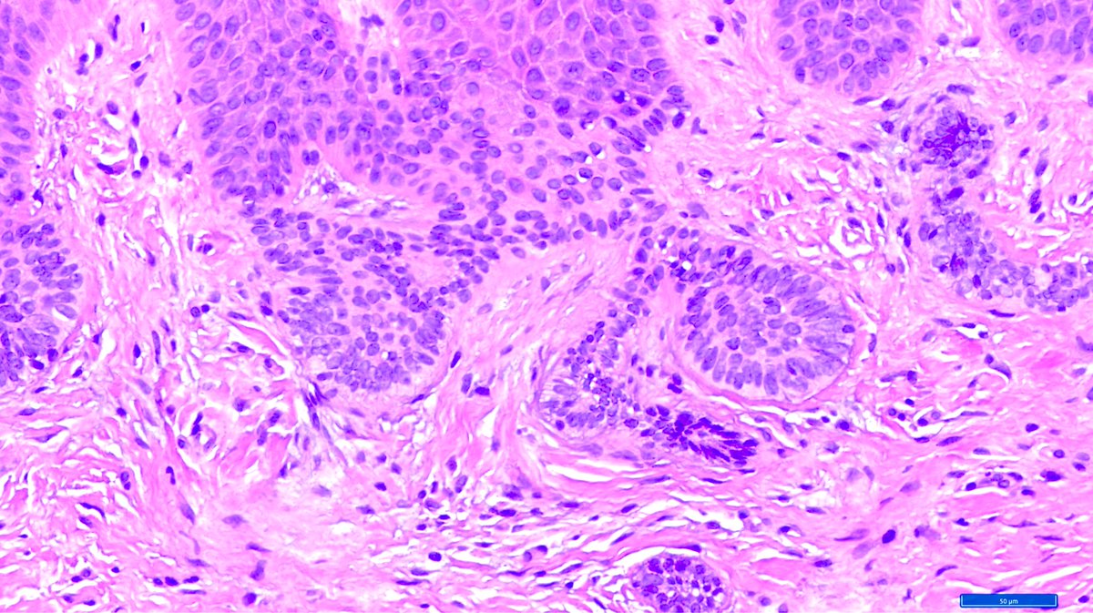 Hashimoto__0's tweet image. Oral cavity, gingiva