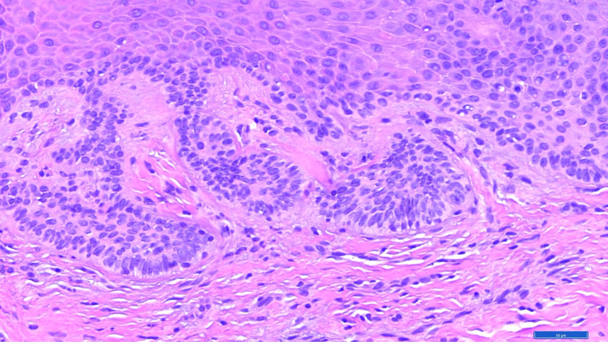 Hashimoto__0's tweet image. Oral cavity, gingiva