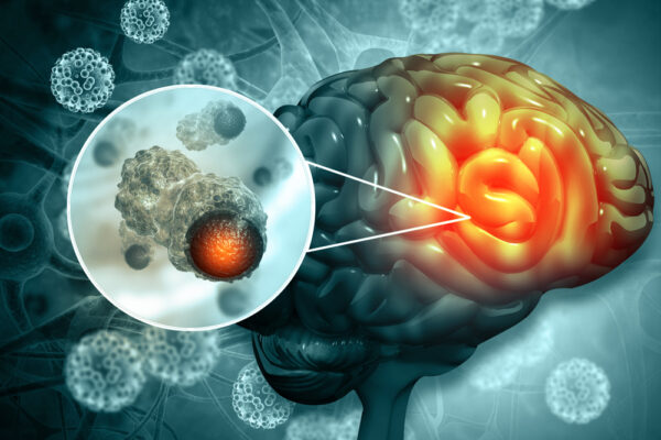 OncoDaily (@oncodaily) on Twitter photo Mark Hughes Foundation Centre for Brain Cancer Research Announces Six MHF Innovation Grant Recipients
<a href="/MarkHughesFdn/">MarkHughesFoundation</a> <a href="/HaghighiNeda/">Neda Haghighi</a> <a href="/LSatgunaseelan/">Laveniya Satgunaseelan</a> <a href="/ernest_moles/">Ernest Moles</a>
oncodaily.com/blog/mark-hugh…
#Cancer #CancerResearch #BrainCancer #MHF #MedX #MedNews #MedEd #Grant #Medicine #Health Mark Hughes Foundation Centre for Brain Cancer Research Announces Six MHF Innovation Grant Recipients
<a href="/MarkHughesFdn/">MarkHughesFoundation</a> <a href="/HaghighiNeda/">Neda Haghighi</a> <a href="/LSatgunaseelan/">Laveniya Satgunaseelan</a> <a href="/ernest_moles/">Ernest Moles</a>
oncodaily.com/blog/mark-hugh…
#Cancer #CancerResearch #BrainCancer #MHF #MedX #MedNews #MedEd #Grant #Medicine #Health