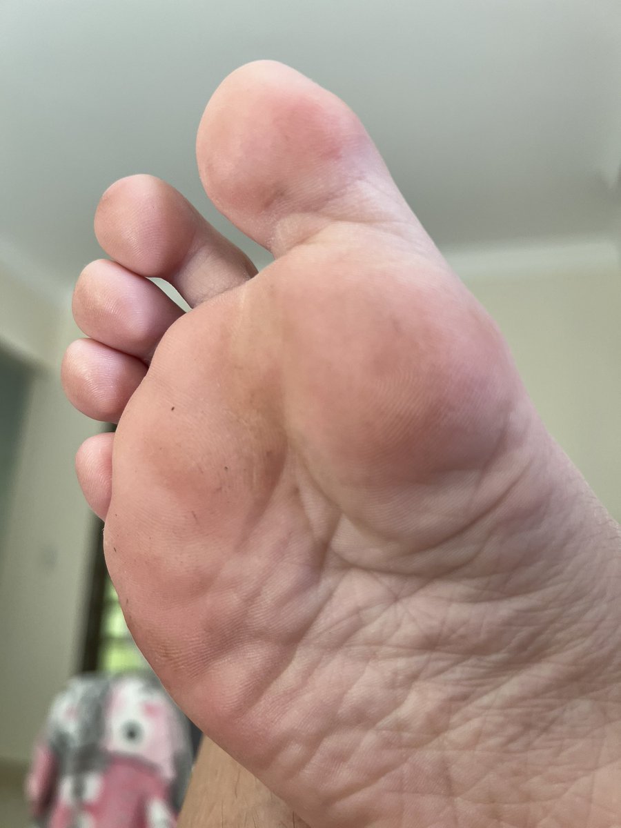 findomtsh's tweet photo. o teu pintinho fica duro com minha sola, né? 

admita que cada detalhe nessa sola rosada e maravilhosa te deixa com os pensamentos altos. 

admita, fica mais duro com solas do que sexo convencional. https://t.co/C6GkIWMxeG