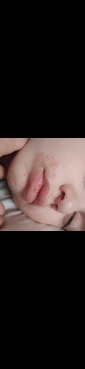 فني أسنان tweet media