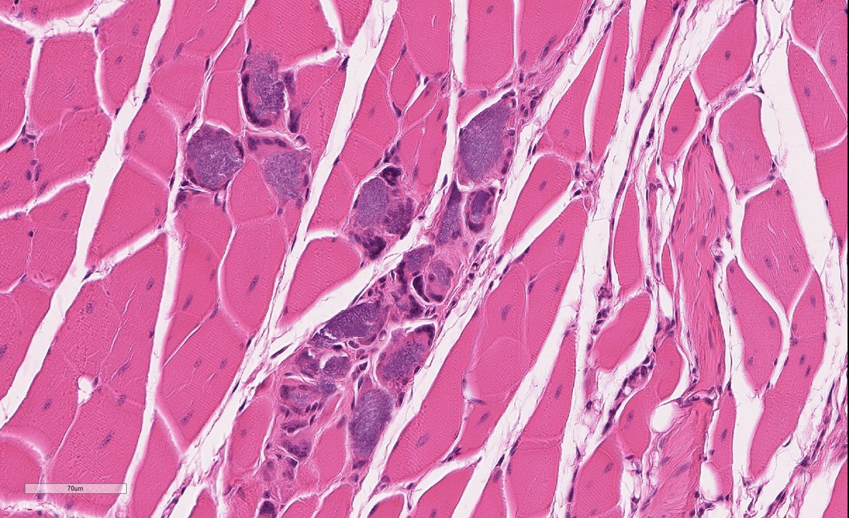 Why some of the regenerated myofibers (NOD🐁 1 month post-ischemia) are so hematoxyphilic!?😳