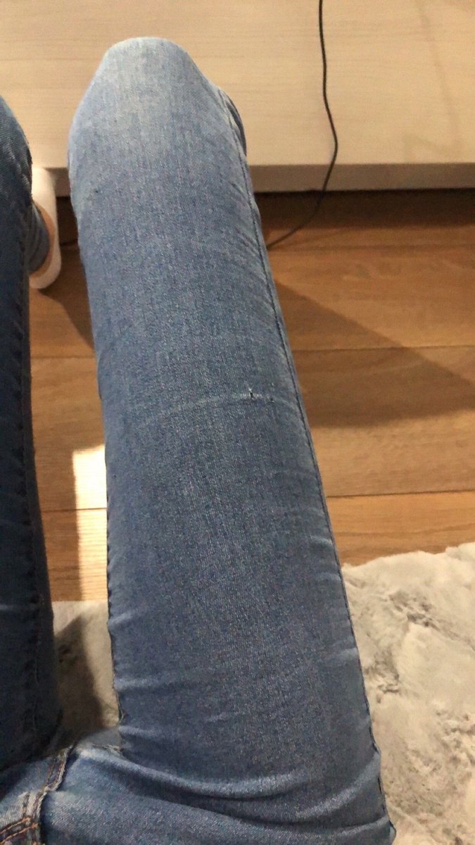 To all the girls who have/used to have these kind of legs WHAT DID YALL DOO😭