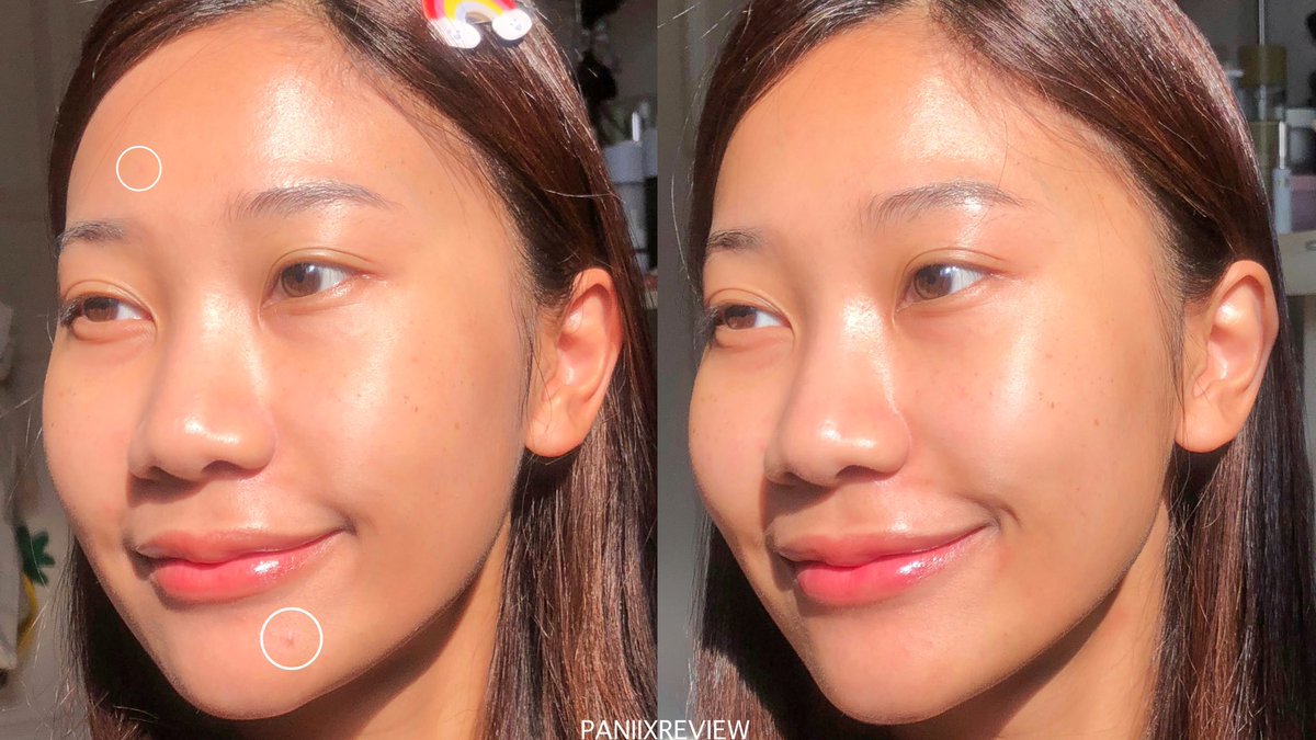 วันสาวๆ เดือนนี้สิวผุดขึ้นมาเฉยเลย 🥲 จบที่ Mentholatum Acnes Deep Wash Cleanser หลอดเขียว เป็นโฟมเวชสำอางลดสิวคุมมันที่แท้ทรู นี่ใช้เช้าเย็นครบ 1 วีค = สิวแห้ง สิวใหม่ไม่ขึ้นแล้ว✔️ ตอนล้างรู้สึกผิวสะอาดมากๆ กลิ่นหอมอ่อนๆ หลอดเล็กราคาน่ารักมาก น้องๆ นักเรียนซื้อได้สบาย หนึ่งแบงค์แดงมีทอน พิกัด #รีวิวเซเว่น คับ #ใช้ดีบอกต่อ #โฟมลดสิวเซเว่น