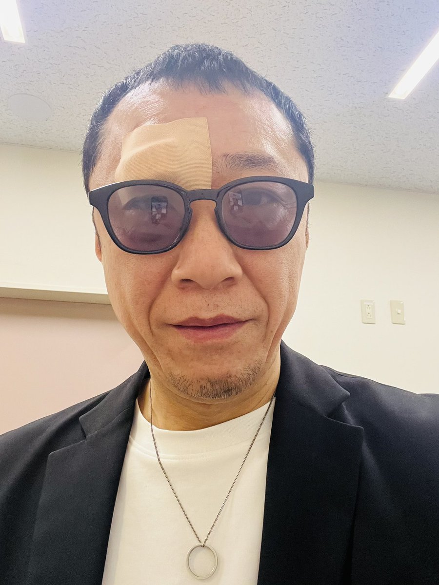歩行中にガラス扉に気付かず顔面をぶつけてしまい、眉の辺りを数針縫う
