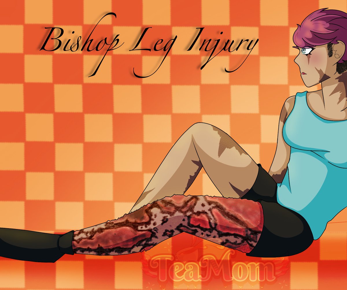 BishopDTSmp's tweet photo. Ever wondered what was under that bandage on my leg? Here you go!! 

Tw// Slight gore https://t.co/zSWf2VTDSH