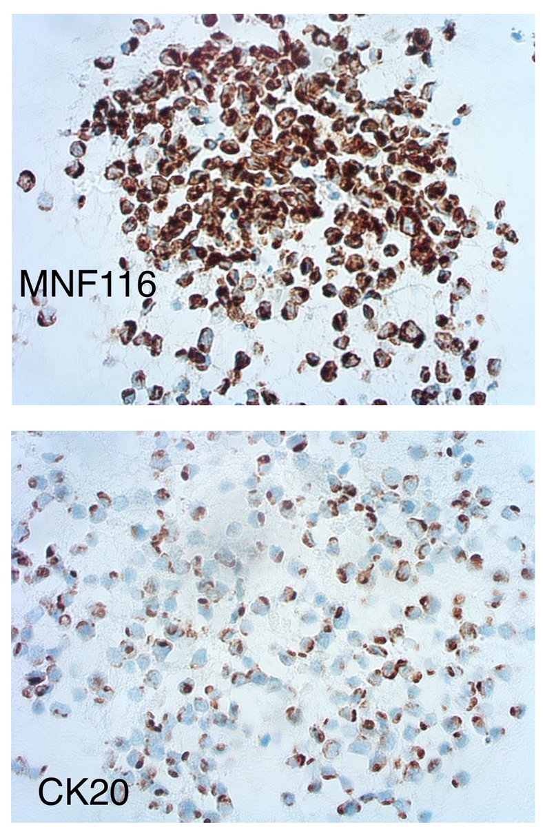 Tim Bracey tweet media