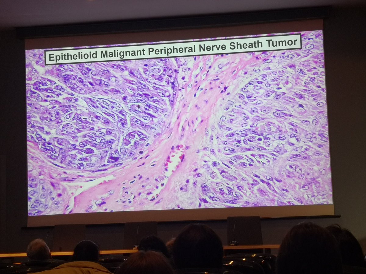 path_insights98's tweet photo. Dr. Angelo Paolo Dei Tos ending the #BSTPathology course 2025 in Barcelona, Spain with the lecture “How to avoid diagnostic errors in soft tissue pathology: a survival guide”. 📝
Last picture attached is a case from my personal archive related to the topic discussed. 🔬
#PathTwitter #BSTPath
#HMAR_BASTPC25 #PathX