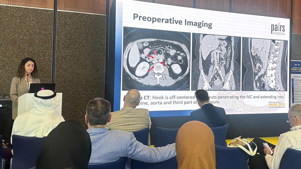 Donna Salam (@donnasalam) on Twitter photo Proud to see <a href="/Diana_Kokash/">Diana Kokash</a> deliver such a great talk on ‘Challenging IVC filter Retrievals’! #PAIRS2025 Proud to see <a href="/Diana_Kokash/">Diana Kokash</a> deliver such a great talk on ‘Challenging IVC filter Retrievals’! #PAIRS2025