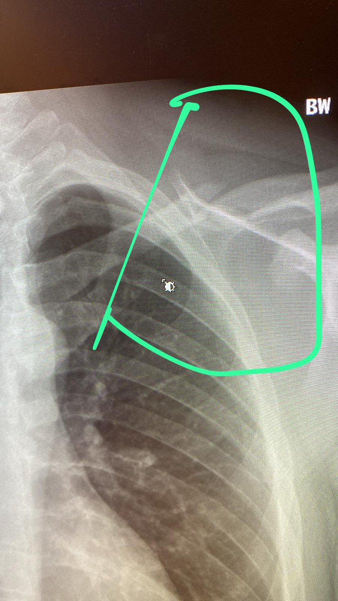 Curtis910's tweet photo. Surgery was a success today, on the road to recovery #LevelUp https://t.co/C1KPhCdXs2
