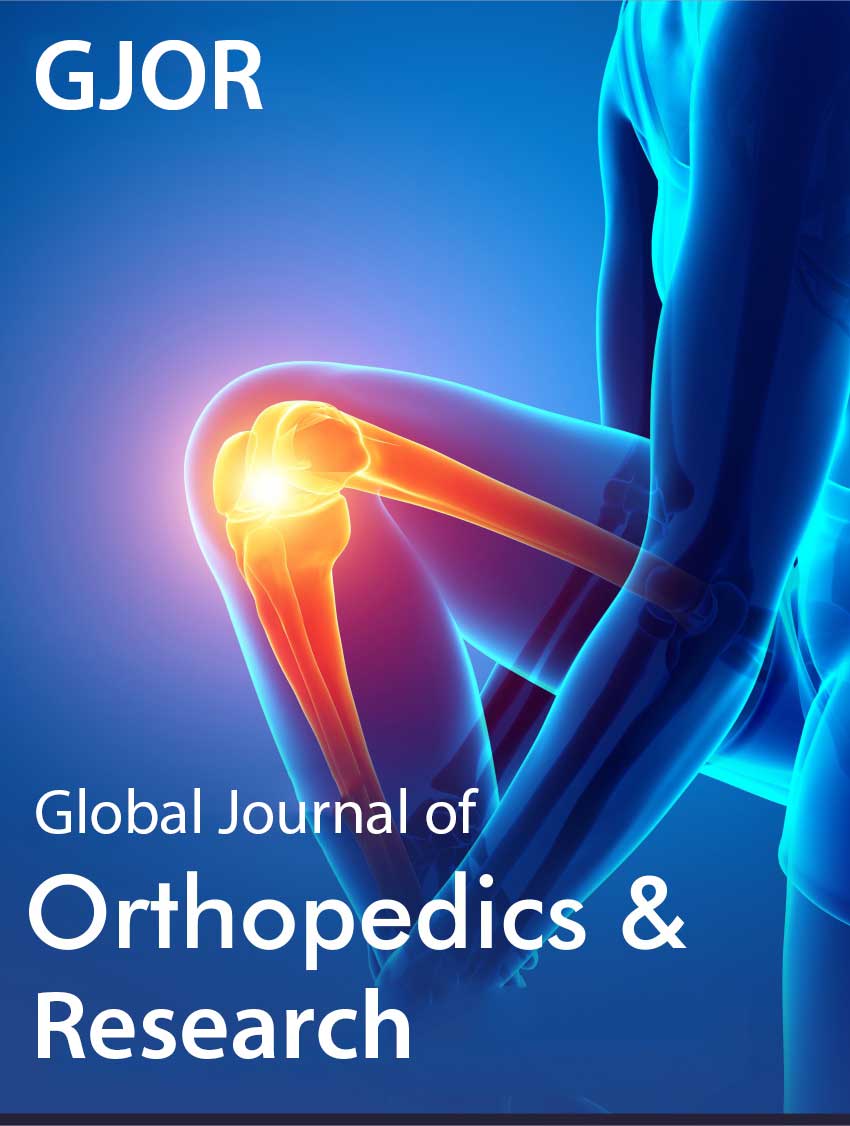 IrisPublishers's tweet photo. Fibular Hemimelia: A Case Series of Nine Patients Treated with Syme Amputation by Julio Avila in #IrisPublishers
https://t.co/QYTfZI2AHc https://t.co/IAeYvdJF1V