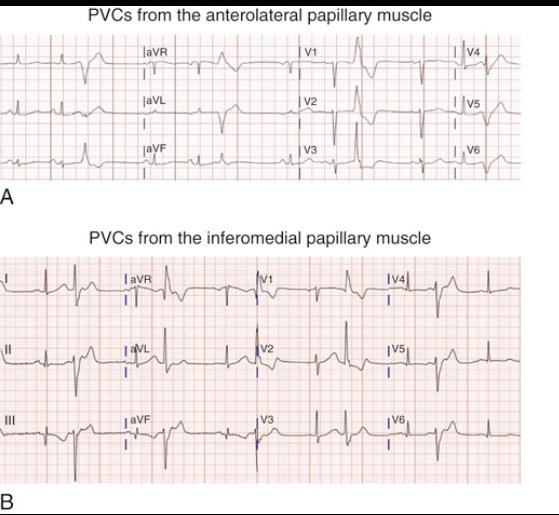 CardiovascularCorner tweet media