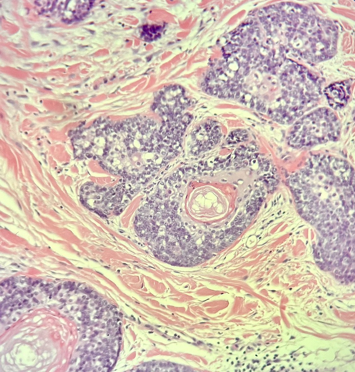 Francesco Fortarezza tweet media