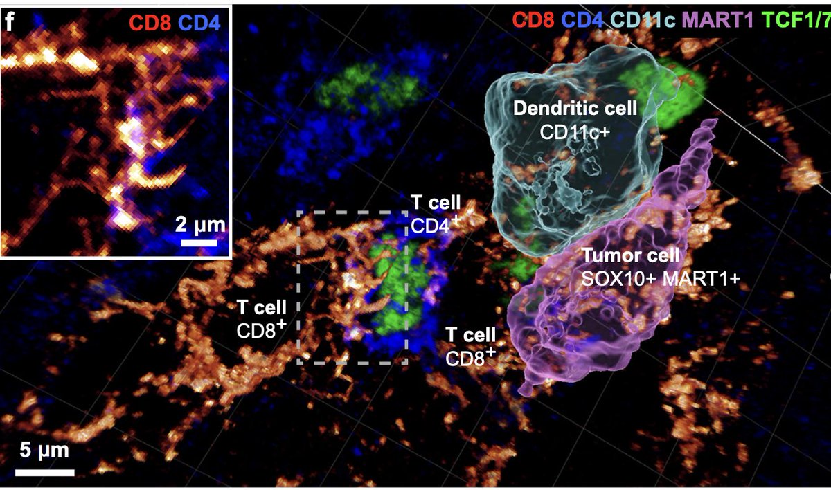 Anirban Maitra (@aiims1742) on Twitter photo I can't get over these 3D spatial images in the latest preprint from <a href="/sorger_peter/">Peter Sorger</a> <a href="/ajitjohnson_n/">Ajit Johnson Nirmal</a> et al.
The preprint is a roadmap on how to conduct 3D cyclic immunofluorescence using "thick" archival sections and precisely map cell-cell interactions
biorxiv.org/content/10.110… I can't get over these 3D spatial images in the latest preprint from <a href="/sorger_peter/">Peter Sorger</a> <a href="/ajitjohnson_n/">Ajit Johnson Nirmal</a> et al.
The preprint is a roadmap on how to conduct 3D cyclic immunofluorescence using "thick" archival sections and precisely map cell-cell interactions
biorxiv.org/content/10.110…