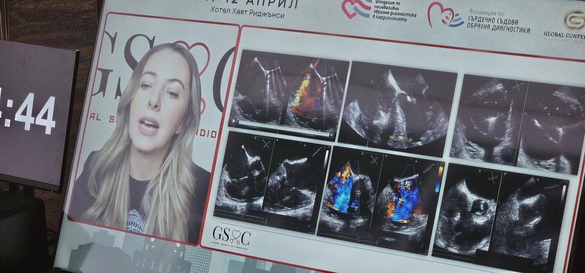 Abdallah Almaghraby (@dr_maghraby) on Twitter photo A very educative lecture about 2D and 3D assessment of Tricuspid valve by <a href="/KemalogluOz/">Tuğba Kemaloğlu Öz, A/Prof</a> at Sofia Echo Days 2025 congress.
<a href="/WorldEcho2/">Krasimira Hristova</a>
#echo #echofirst A very educative lecture about 2D and 3D assessment of Tricuspid valve by <a href="/KemalogluOz/">Tuğba Kemaloğlu Öz, A/Prof</a> at Sofia Echo Days 2025 congress.
<a href="/WorldEcho2/">Krasimira Hristova</a>
#echo #echofirst