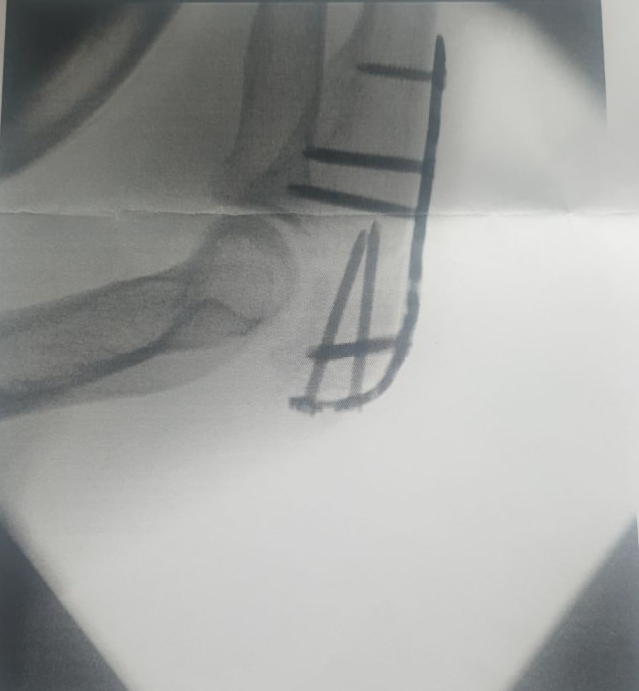 Allyourbase Degenhard | #🅂🄴🄻🄻🄽🄴🅅🄴🅁 | 🍌🇩 tweet media