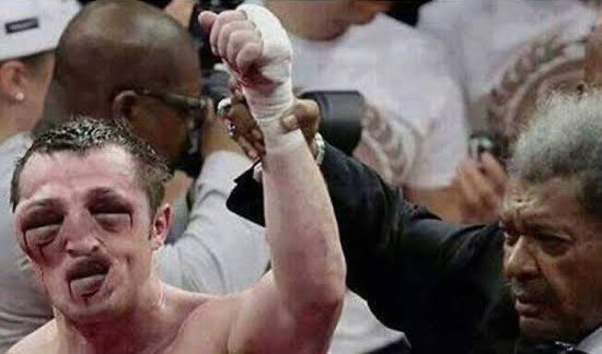MarangoKuda's tweet photo. When winning is painful.... 🤣🤣🤣 https://t.co/DPlhegeURX