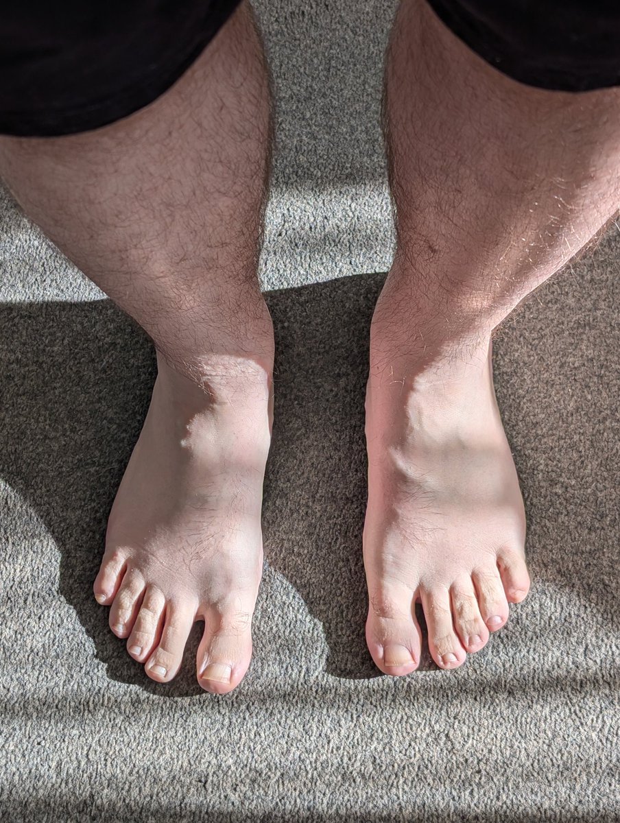 Sunkissed feet