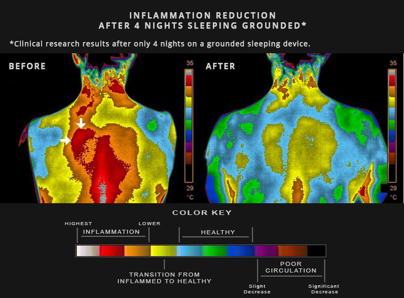 Inflammation.

The secret cause of every chronic disease from obesity to heart disease.

10 cheat codes to cure your inflammation:

1. Grounding