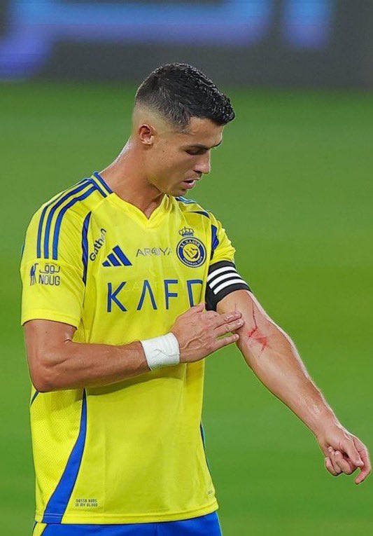 Nightwatch tweet media