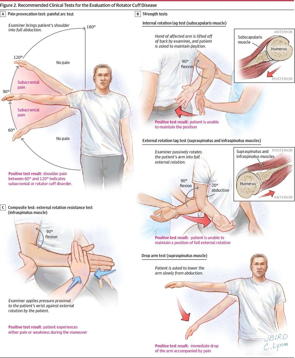 Rotator cuff exam