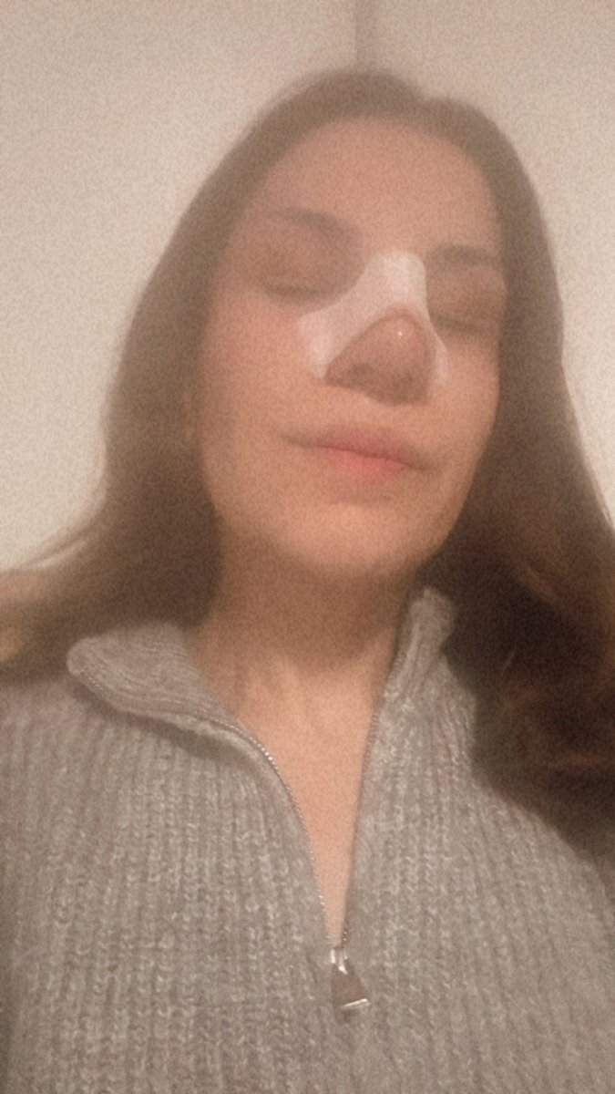 Asli3616's tweet photo. Yazıklar olsun. Bir gün ölürsem sorumlusu SİZSİNİZ!

Ben bu Ülkeye olan inancımı kaybettim. Adalete olan inancımı kaybettim. Siz beni tüm ümitlerim ile yaşarken öldürdünüz! Istanbul İl Emniyet Müdürlüğü Sirkeci Polis Merkezi Amirliğine bağlı Suç Araştırma' da görevli Polislerimiz olaya ilişkin görüntüleri bulup tespit ettiler, şahısların beni darp ettikleri herşey mevcut. Burnum kırıldı kalıcı hasar mevcut ay sonunda 3'ncü ameliyatımı olacağım, şahısları bir kere dahi olsa yakalamadınız, tutuklamadınız, cezaevine koymadınız! Olay anında tabureyi alıp üzerime defalarca saldırdılar, ancak vuramadılar aldığım darbe yumruk darbesiydi ve ben başka bir aracım üzerine uçtum. 

Ünlü değilim diye mi tutuklamadınız? Ben bu Ülkenin bir ferdi değilmiyim? Bu topraklar için ölebilecek sevgiye sahibim ben, değerim yok mu? 

Anladım ben Ünlü değilim "INSAN" sıfatında yer almıyorum, anladım canımın kıymeti yokmuş. Danla Biliç kadar kıymetli değilmişiz demek. 

@adalet_bakanlik 

#danlabiliç #ADALET_ISTIYORUZ #Adaletİçin #kadınavecocugadokunma #KadınaSiddet #şiddet
