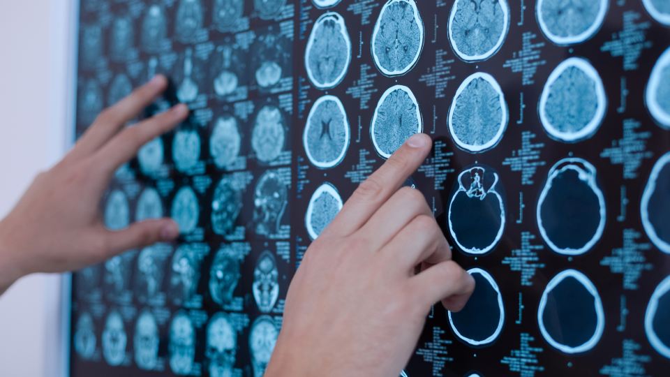 Loughborough University (@lborouniversity) on Twitter photo Dr <a href="/mandakpearce/">Amanda Pearce</a>, has been awarded funding by the Academy of Medical Sciences, <a href="/acmedsci/">Academy of Medical Sciences</a>, to tackle dementia.
The research focuses on the synthesis and application of fluorescent polymer nanoparticles in a range of healthcare applications.
Read more ➡️ lboro.uk/4jxXAVD Dr <a href="/mandakpearce/">Amanda Pearce</a>, has been awarded funding by the Academy of Medical Sciences, <a href="/acmedsci/">Academy of Medical Sciences</a>, to tackle dementia.
The research focuses on the synthesis and application of fluorescent polymer nanoparticles in a range of healthcare applications.
Read more ➡️ lboro.uk/4jxXAVD